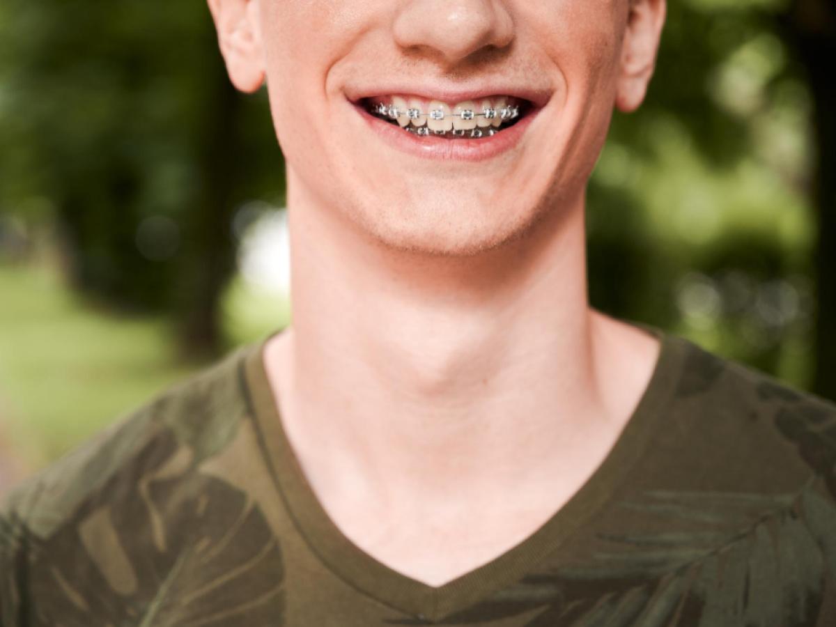 braces